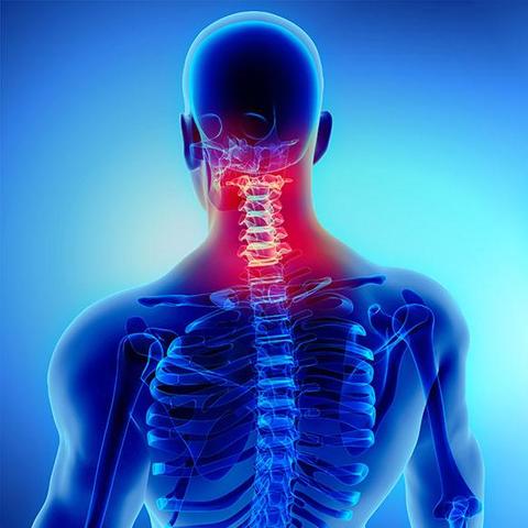 Neck Pain