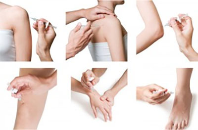 Injections around joints